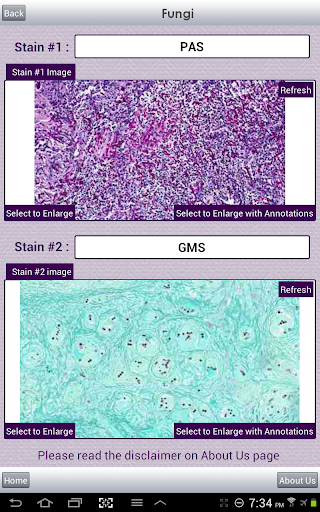 【免費醫療App】myDermPath-APP點子