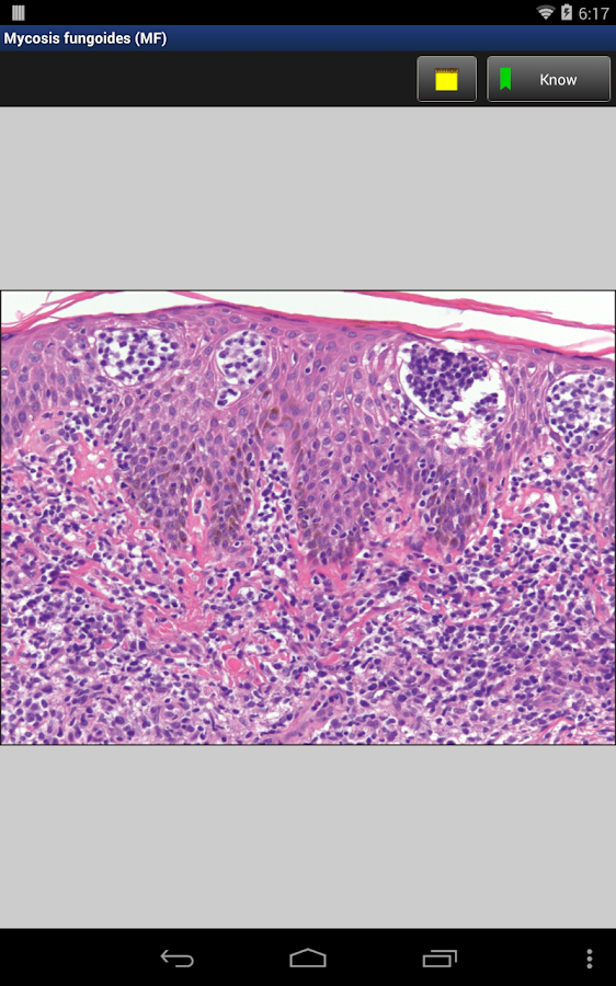 Anatomic Pathology Flashcards Android Apps on Google Play