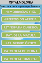 ophthalmology poster 14