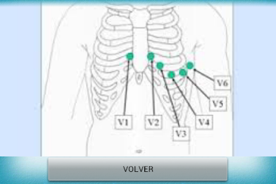 Electrocardiograma PRO poster 16