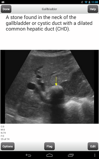 【免費教育App】ARDMS Abdomen Ultrasound Cards-APP點子