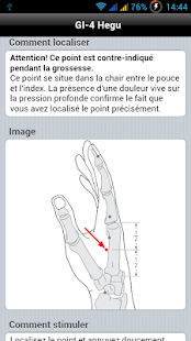 Acupressure: Headache Relief(圖6)-速報App