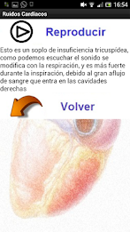 Sonidos Cardiacos poster 4