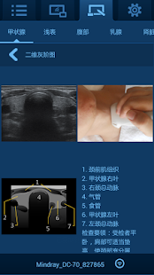 MedTouch(圖7)-速報App