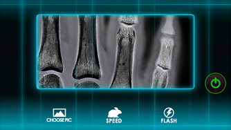 Download X-Ray Scanner: Augmented Prank Apk for Android-atticlab.xray