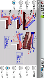 ブルンストロームステージ（片麻痺機能検査）(圖4)-速報App