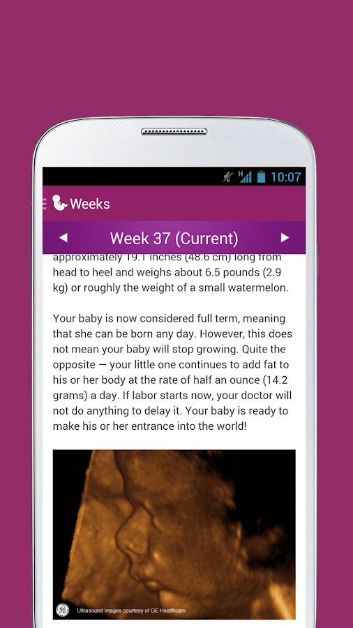   I'm Expecting - Grossesse- capture d'écran 