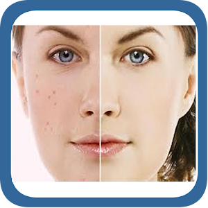 A-Z Acne.apk 1.0