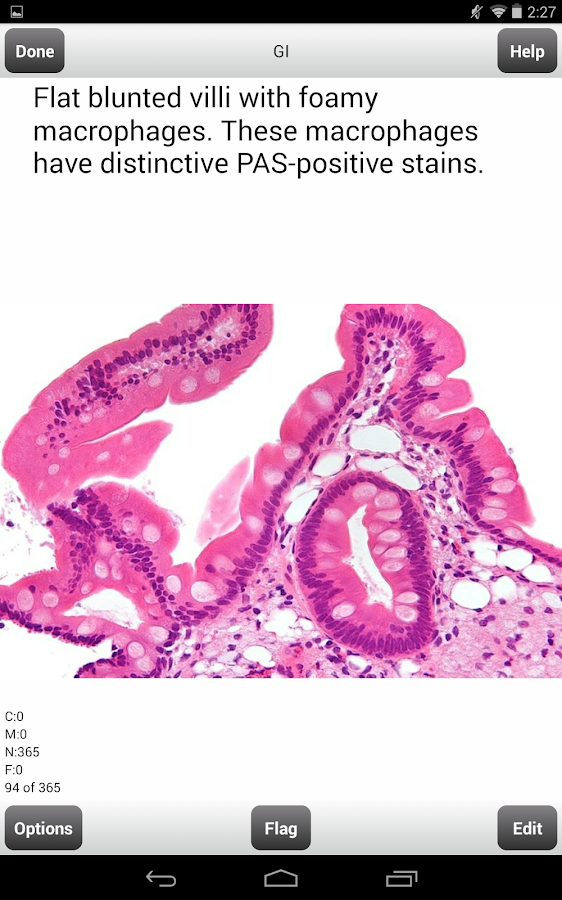 USMLE Step 2 CK Flashcards Android Apps on Google Play