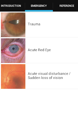 Eye Emergency Manual