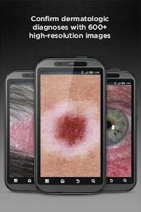 Dermatology DDx - screenshot thumbnail