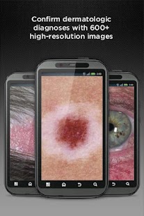 Android  Dermatology DDx v2.6.57 Ky8FNtGDlwQf3p_1NVAZxNJ6rvZWf6HCFkh_jJ473CnWt2v-6NvwjUo7p-an35ZGKf0=h310