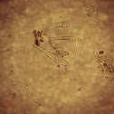 Freshwater diatom