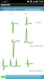 Electrocardiograma poster 16
