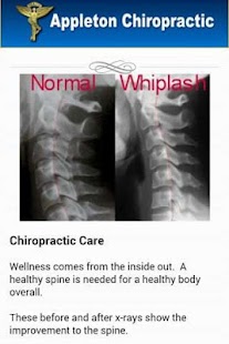 How to get Appleton Chiropractic 2.1 mod apk for bluestacks