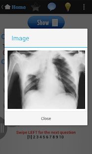 USMLE Exam Prep(圖4)-速報App