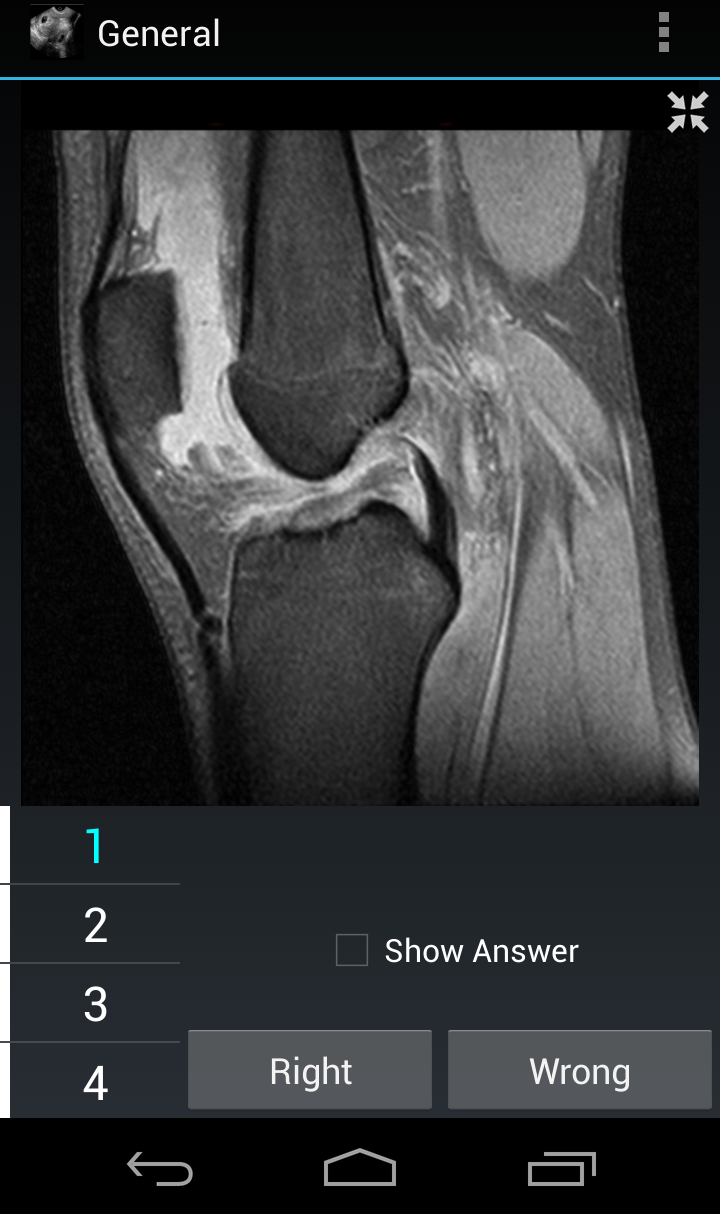 Radiology Flashcards: General Screen 2