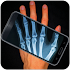 XRay Body Scanner Simulator3.1