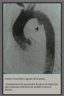 Radiografias de examenes(圖2)-速報App