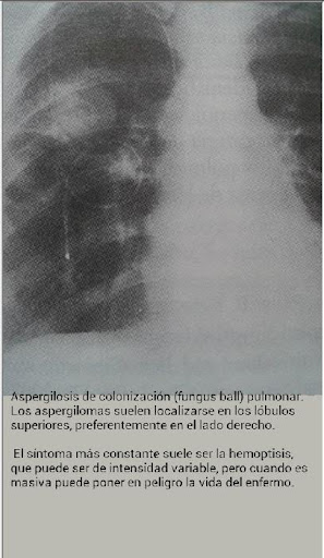 【免費醫療App】Radiología-APP點子