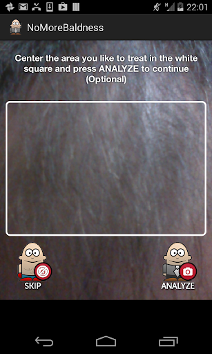 【免費健康App】No More Baldness-APP點子