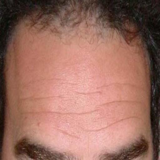 Forehead Reading