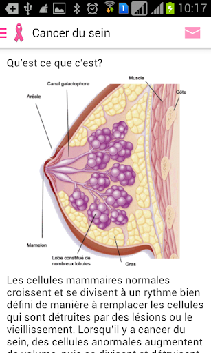 Cancer du sein