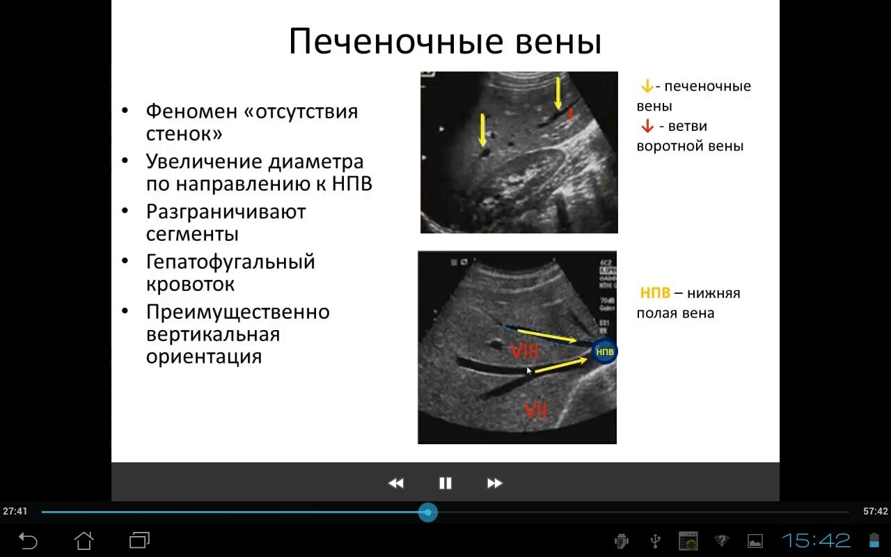 Основы УЗ анатомии печени Screen 3
