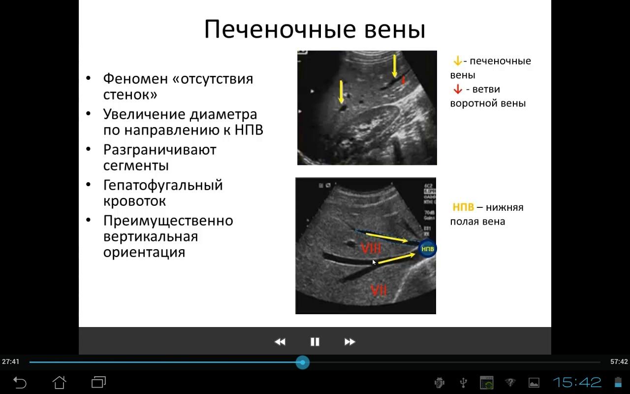 Узи сосудов печени