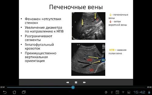Android application Основы УЗ анатомии печени screenshort