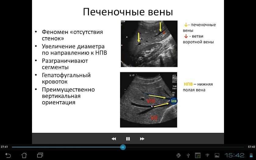 Основы УЗ анатомии печени Screen 1