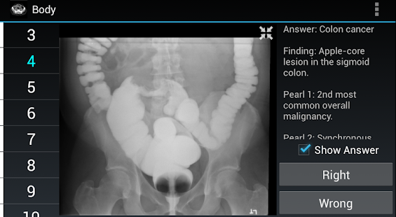 How to download Radiology Flashcards: Free patch 1.4 apk for pc