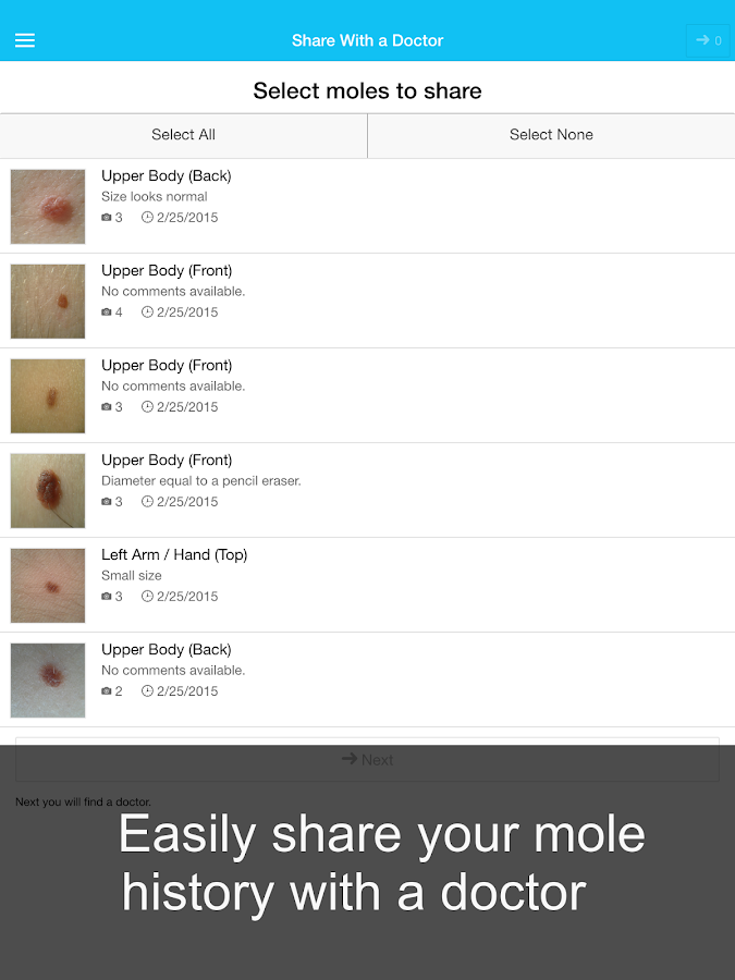    Skin Cancer App - MySkinPal- screenshot  