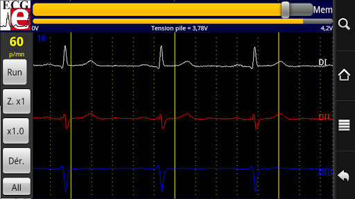 ElektorCardioscope