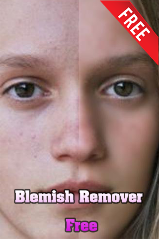 【免費攝影App】Blemish Remover Free-APP點子