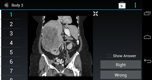 Radiology Flashcards: Body 3