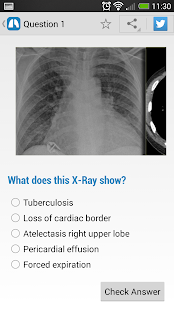 免費下載醫療APP|Chest X-Ray Training app開箱文|APP開箱王