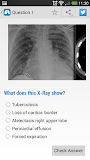 Chest X-Ray Training