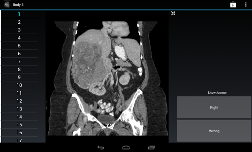 【免費醫療App】Radiology Flashcards: Body 3-APP點子