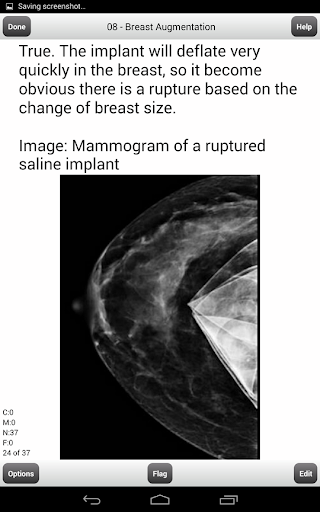 【免費教育App】ARDMS BREAST ULTRASOUND LITE-APP點子