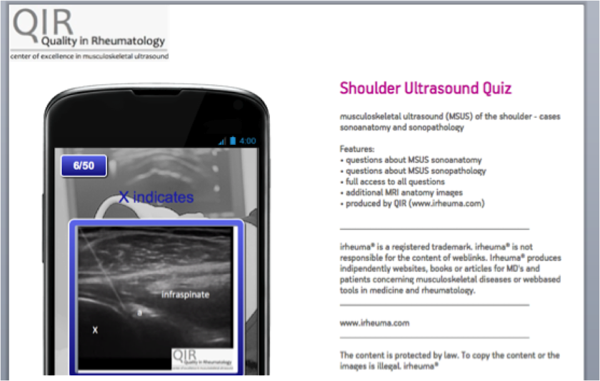 Shoulder Ultrasound Screen 2