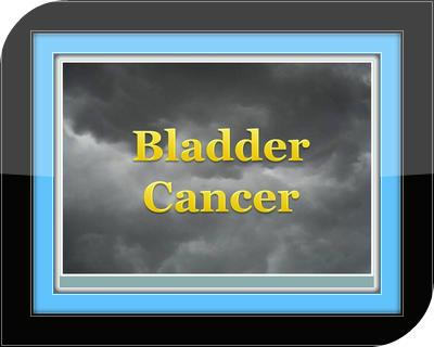 Bladder Cancer - Guide