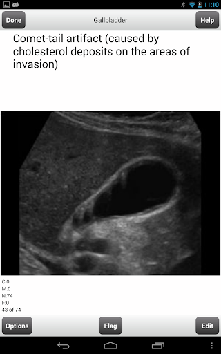 免費下載教育APP|ARDMS Ultrasound Flashcards Lt app開箱文|APP開箱王