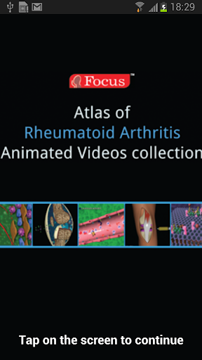 Atlas of Rheumatoid Arthritis