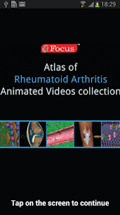 How to install Atlas of Rheumatoid Arthritis lastet apk for android
