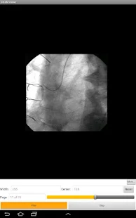 LEADTOOLS DICOM Viewer App(圖3)-速報App
