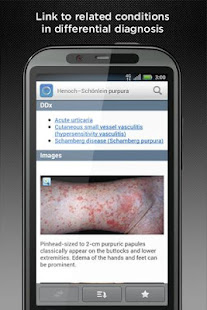 Dermatology DDx(圖4)-速報App