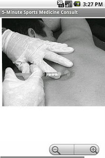 5-Minute Sports Medicine(圖5)-速報App
