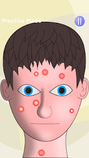 How to get Pimples Squeezing 1.14 mod apk for bluestacks