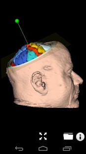 Free KiwiViewer APK for PC